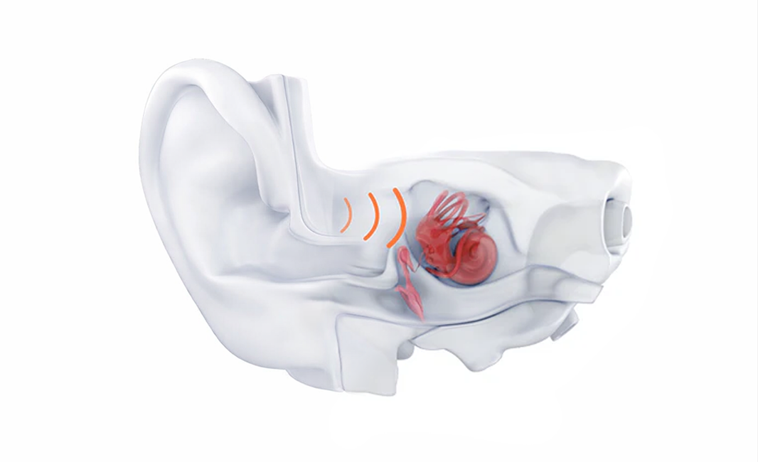 How Bone Conduction Creates Personalized Sleep Therapy